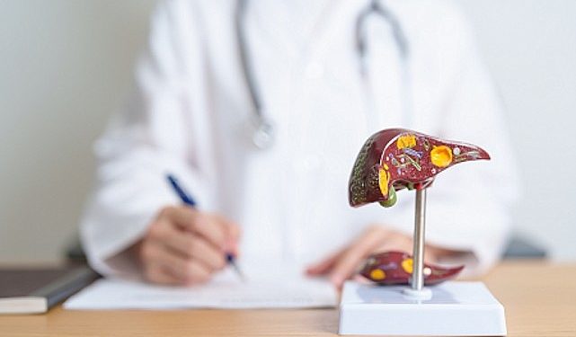 Siroza Bağlı Komplikasyonların Önlenmesi İçin Sistemli Denetimler ve Tedavinin Takibi Önemli!