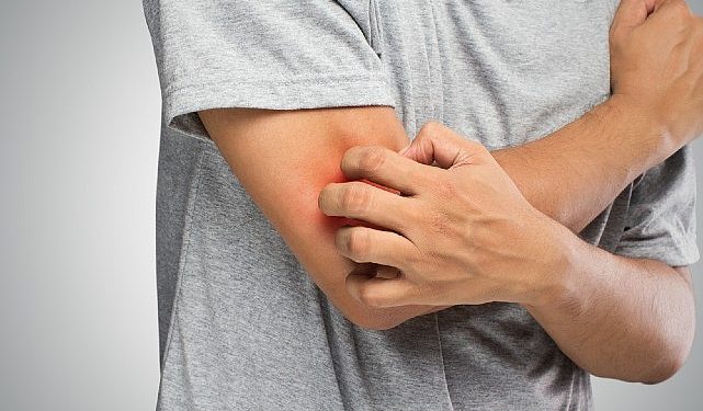 Mantar Hastalığı Hakkında Bilinmesi Gereken 6 Değerli Bilgi!