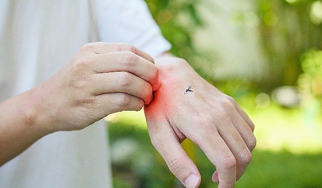 Sivrisinek Isırmasından Sonra Yüksek Ateş Ve Eklemlerde Ağrı Varsa Kesinlikle Hekiminize Danışın