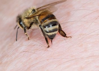 Arı sokmasında Adrenalin Otoenjektörü hayat kurtarıyor