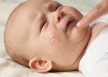 Atopik Dermatit Çocuklarda Daha Sık Görülüyor