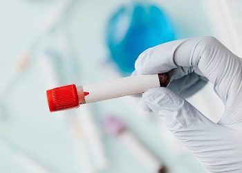 Sepsis: Bedenin Sessiz Fırtınası