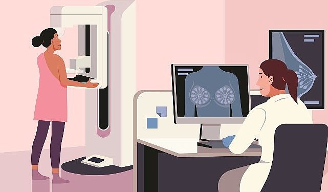 2 Yılda Bir Tedbir Hedefli Mamografi Çekilmeli!