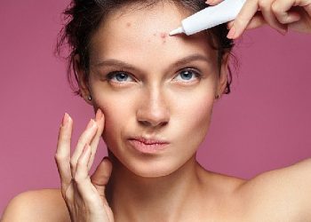 Akne tedavisinde yapılan 10 kıymetli kusur !