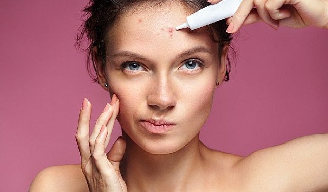 Akne tedavisinde yapılan 10 kıymetli kusur !